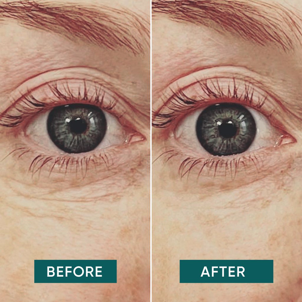 Genanvendelige silikonemasker til omkring øjnene med C-vitamin effekt, ansigtsmaske til hudpleje, bæredygtig skønhed