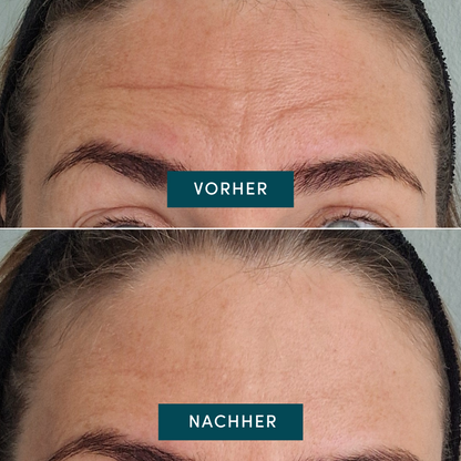 Nærbillede af ansigtsmaske med ingredienser, hudpleje, C-vitamin, hudforbedring, skønhedsprodukt