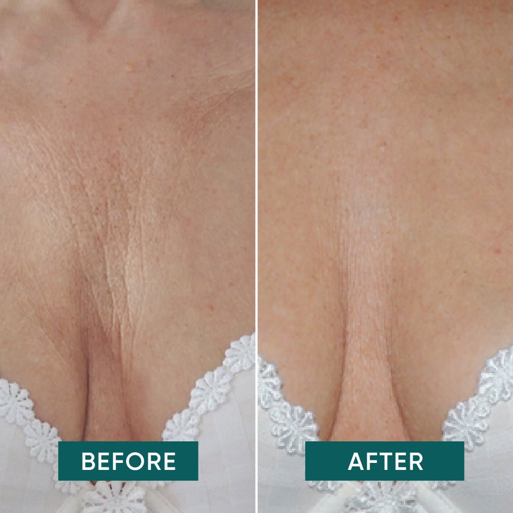 Genanvendelig silikonemaske til décolleté med Ectoin effekt, miljøvenlig hudpleje